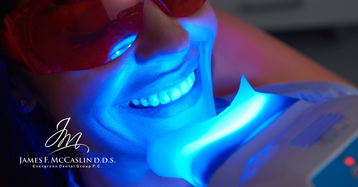 Professional Teeth Whitening in Omaha, NE Evergreen Dental Group